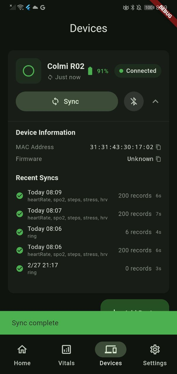 Watch Insights — Visualización